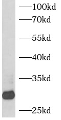 BCAP31 antibody|BCAP31抗体