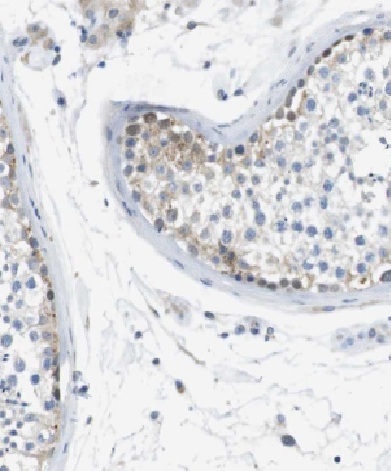 CCL27 antibody|CCL27抗体