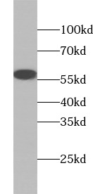 TGFB3 antibody|TGFB3抗体