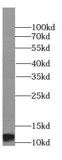 H4C1 antibody|H4C1抗体 FNab03878