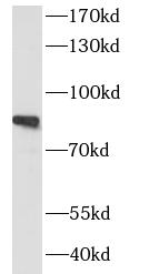 SIK1 antibody|SIK1抗体
