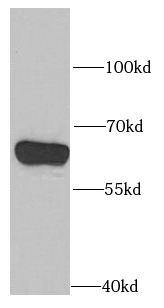 PPP2R1B antibody|PPP2R1B抗体