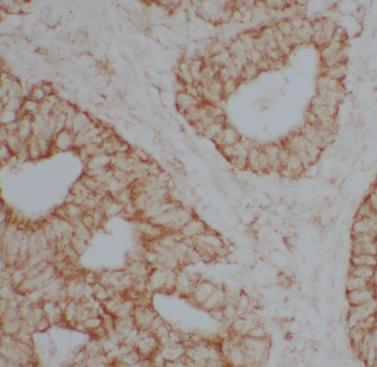 DBH antibody|DBH抗体 FNab09982