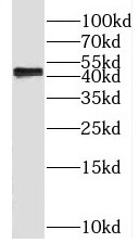 Phospho-SPHK1 (Ser225) antibod
