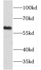 FMO5 antibody|FMO5抗体