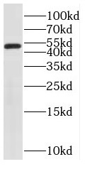 SNX15 antibody|SNX15抗体