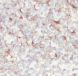 CCR7 antibody|CCR7抗体