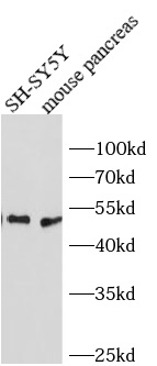 INSM1 antibody|INSM1抗体