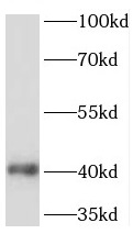 TMEM25 antibody|TMEM25抗体