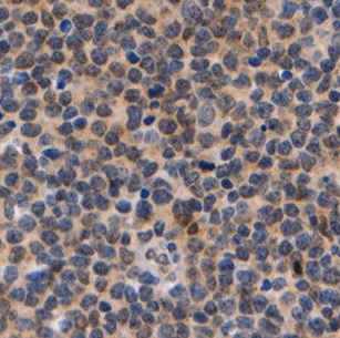 DNTT antibody|DNTT抗体