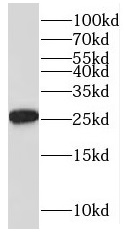 GINS4 antibody|GINS4抗体