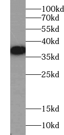 ACBD4 antibody|ACBD4抗体