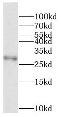 F12 antibody|F12抗体 FNab02938