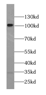CTNNA2 antibody|CTNNA2抗体