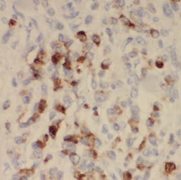 SYNJ2BP antibody|SYNJ2BP抗体