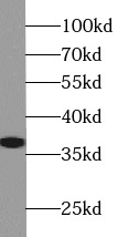 APEX1 antibody|APEX1抗体 FNab004