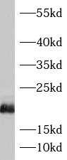 ASF1B antibody|ASF1B抗体