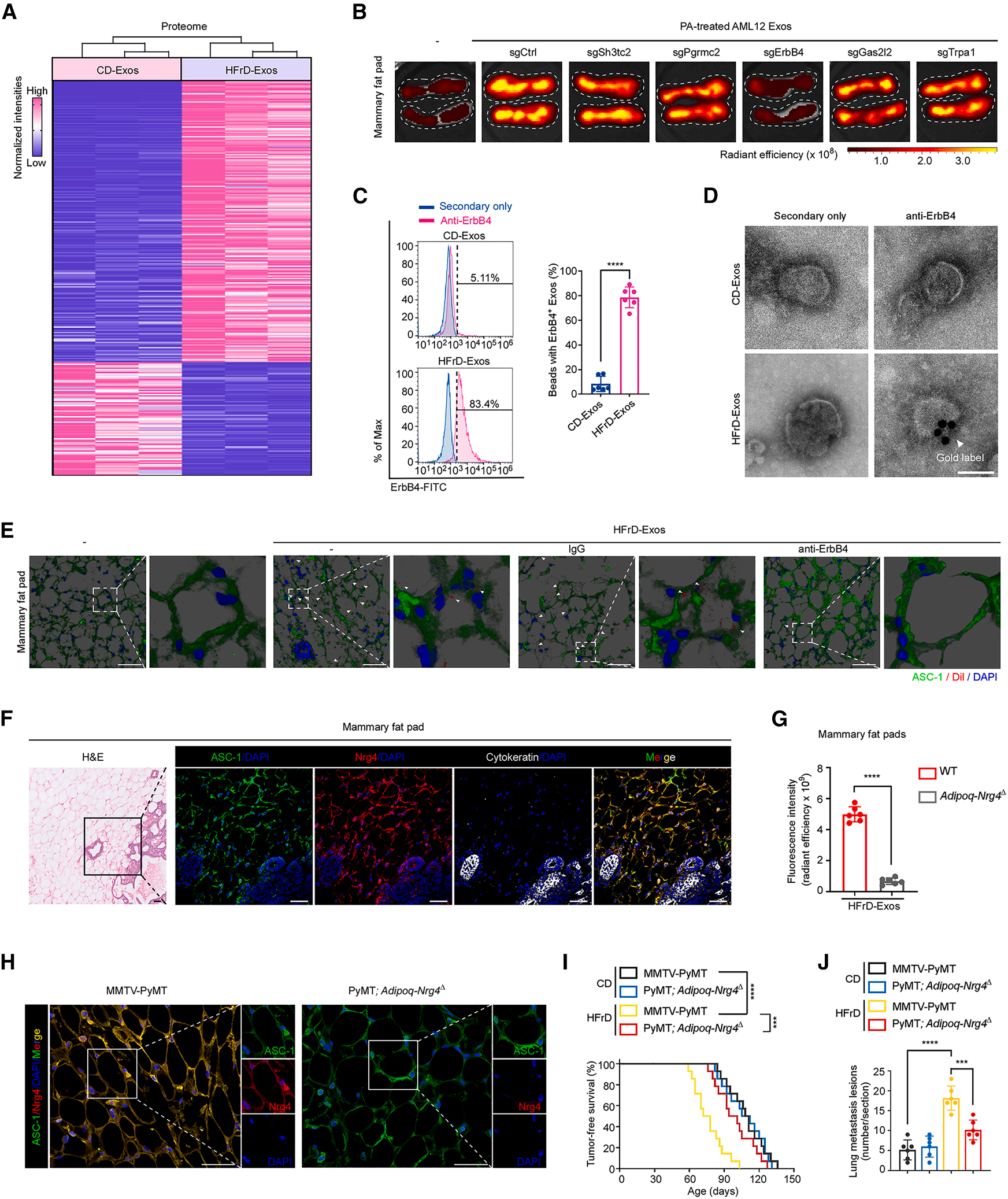 Cell Metabolism | 脂肪肝竟是乳腺癌的“远程指挥官”？科学家揭秘它的致癌信使