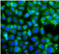 USP10 antibody|USP10抗体 FNab101