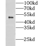 CLUAP1 antibody|CLUAP1抗体