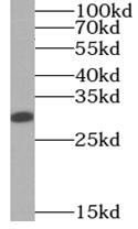 RNASET2 antibody|RNASET2抗体