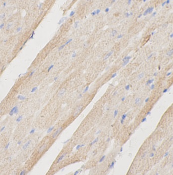 FUCA2 antibody|FUCA2抗体 FNab102