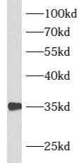 ATF1 antibody|ATF1抗体
