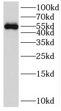 SOX10 antibody|SOX10抗体