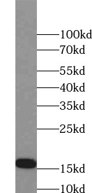 LC3B-Specific antibody|LC3B抗体
