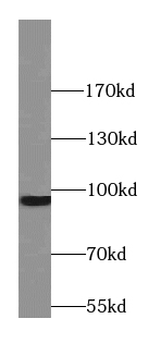 STT3B antibody|STT3B抗体
