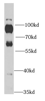 RPH3A antibody|RPH3A抗体