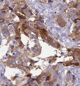 UBE2G2 antibody|UBE2G2抗体