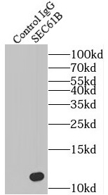 RNH1 antibody|RNH1抗体 FNab07365