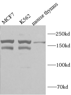 ARID4B antibody|ARID4B抗体