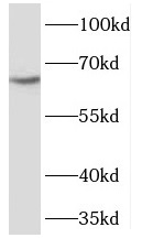 SLCO2A1 antibody|SLCO2A1抗体