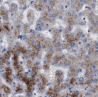 G6PC3 antibody|G6PC3抗体