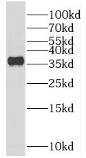 REM2 antibody|REM2抗体