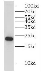 DUSP22 antibody|DUSP22抗体 FNab0
