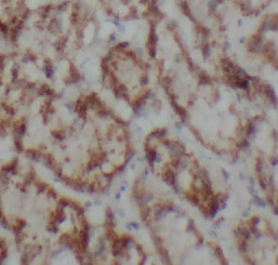 P2RX4 antibody|P2RX4抗体 FNab100