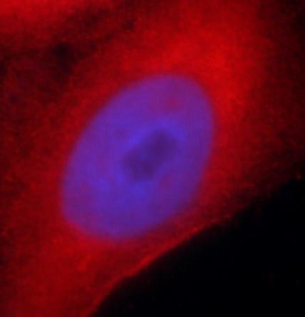 AKR1E2 antibody|AKR1E2抗体 FNab0