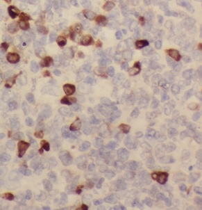 CLEC4M antibody|CLEC4M抗体