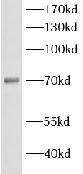 ACSL5 antibody|ACSL5抗体