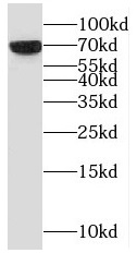 CSF1 antibody|CSF1抗体