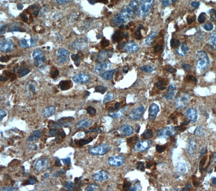 TXNDC16 antibody|TXNDC16抗体