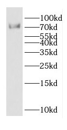 DTL antibody|DTL抗体 FNab02549