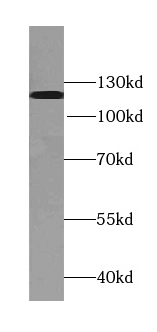 TDRD5 antibody|TDRD5抗体