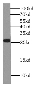 GSTT2B antibody|GSTT2B抗体