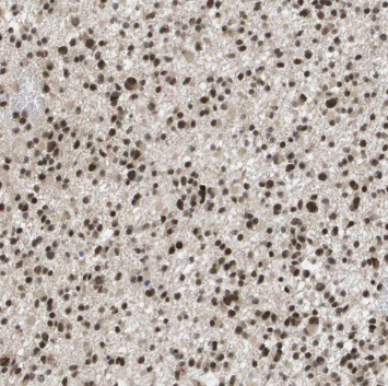 TLE1 antibody|TLE1抗体 FNab08719