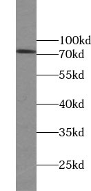 ZNF443 antibody|ZNF443抗体