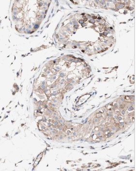MRPL10 antibody|MRPL10抗体